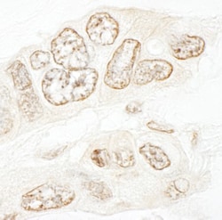 SET1B Antibody, Novus Biologicals 0.1mg; Unlabeled:Antibodies, Polyclonal